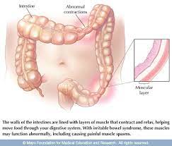 Fyi, i'm male, 27 and had a history of gerd. How To Know If You Have Ibs Or Colon Cancer Quora