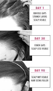 The hair loss treatment products can be purchased separately or as a kit. I Tried Nioxin Hair Regrowth Treatment For 90 Days Momskoop