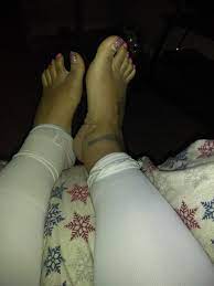 Is It Normal To Have Swelling In Your Feet Ankles After Tt Lipo Photo