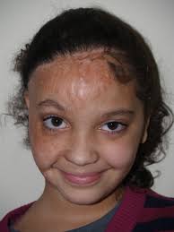 Backgrounder: Operation Restore Case Studies