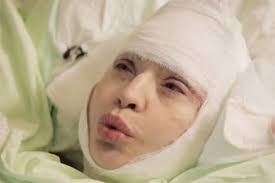 Алиса мон — здравствуй и прощай 06:32. 52 Letnyaya Alisa Mon Uvelichila Grud Radi Vozvrasheniya Na Scenu Shou Biznes Dni Ru