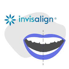 Common tenure of invisalign treatment takes nearly a year for most of the adults, although the exact time does vary from individual to individual. Can Invisalign Correct Adult Midline Misalignment Smile Prep