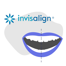 When ready, the individual would return to the dentist's office. Can Invisalign Correct Adult Midline Misalignment Smile Prep