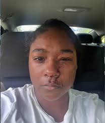 What the helly? Black socialite NBA/WNBA reporter, Tabitha Turner-Wilkins,  allegedly attacks Uber driver in Atlanta, bit her and dug nails in her eye 