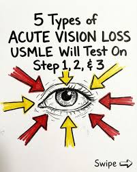 Image result for Acute Vision Loss
