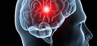 Hirntumor