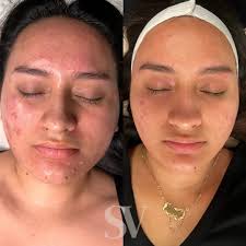 SkinView Esthetics (@skinview.esthetics) · Longview, TX