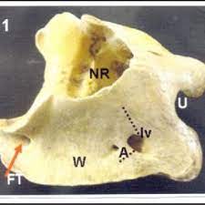 Step by step solution by experts to help you in doubt clearance & scoring excellent marks in exams. Pdf Morphometry Of Cervical Vertebrae Of Camel Camelus Dromedarius