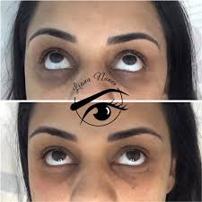 A unique and fun concept for under eye tattoos is the selection of a symbol or term that holds if you are looking for information about meaning of tattoo under eye you being on the right site, because. Dark Circles Camouflage Brazilian Technique