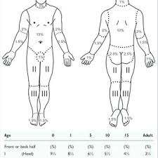 Formulas Proposed For Child Burns Download Table