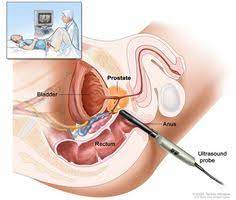 Over the years, published articles about advocates prostatic. 10 Prostate Massage Therapy Ideas Prostate Massage Prostate Massage Therapy