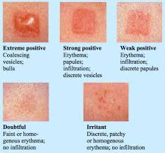 Pin On Healing Wounds