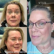 Precision Nurse Aesthetics...