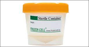 Sample Container 80 Ml To Collect Semen For Preservation Or Processing