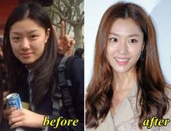 서지혜 / suh jee hye. Seo Ji Hye Plastic Surgery Fact Or Rumor Plastic Surgery Hits