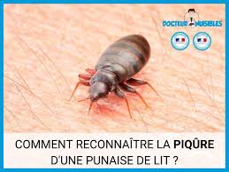 Le premier symptôme de piqûre de punaise de lit est l'irruption de boutons. Piqure Punaise De Lit Comment Reconnaitre Les Piqures De Punaises De Lit