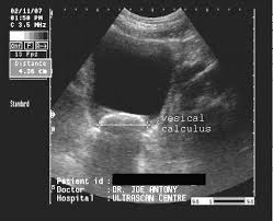 A Gallery Of High Resolution Ultrasound Color Doppler 3d Images Urinary Bladder