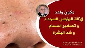 علاج دوالى ااساقين دكتور مازن السقا. Mazen El Sakka Ø§ÙØ¬Ø²Ø§Ø¦Ø± Vlip Lv