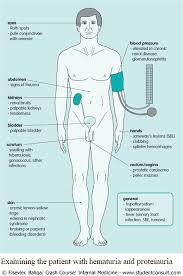 Image result for Isolated Proteinuria