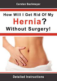 How Will I Get Rid Of My Hernia Without Surgery Detailed Instructions Bachmeyer Carsten 9783844804003 Amazon Com Books