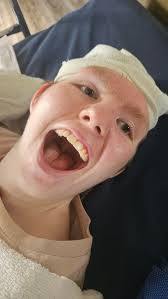 Card train for Teighan after brain injury