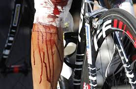 Could this be the worst tour de france crash the famous race has ever seen? Tour De France Crash Johnny Hoogerland And The 201