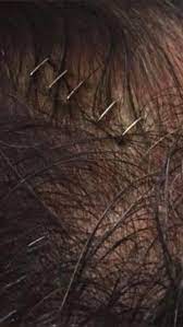 Skrtel bırak hikayeyi arkadaşım kafan yarıldı da ne oldu. Oscar Odulu Bu Sene Senol Gunes In Olur Mu Kizlarsoruyor