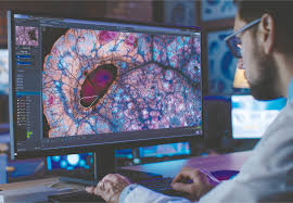 New AI model shows promise for cancer diagnosis - Nierengarten - 2025 - Cancer - Wiley Online Library