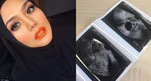 Latest oldest most discussed most shared most viewed. Imbasan Bayi Zulin Aziz Ini Jawabnya Iluminasi