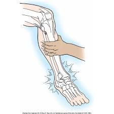 Image result for Squeeze Test