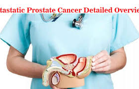 There is no real evidence that prostate biopsies cause prostate cancer to spread, says michael herman, md, director of urologic oncology at south nassau communities hospital in oceanside, ny. Metastatic Prostate Cancer Advanced Prostate Treatment Overview