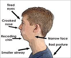 Mouth Breathing And Blocked Nose | Ent Specialist Singapore