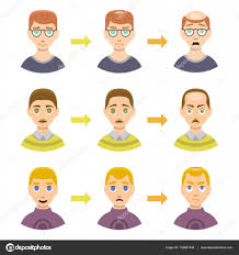 Information Chart Of Hair Loss Stages Types Of Baldness