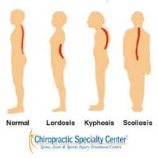 The sooner you consult with a doctor, the better chance you have of treating your condition. Lordosis Kyphosis And Scoliosis Know The Differences
