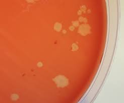 Wie koche ich zuhause richtig meine bohnen ein? fragte sich eine leserin. Clostridium Botulinum Nds Landesamt Fur Verbraucherschutz Und Lebensmittelsicherheit