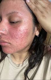 Goodnight drop cashapp, treating 10 people to dinner today 🫶🏽