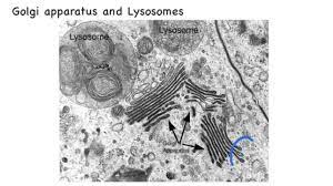Ishita observed a slide of eukaryotic cell under electron microscope. 1 2 Skill Interpretation Of Electron Micrographs Youtube