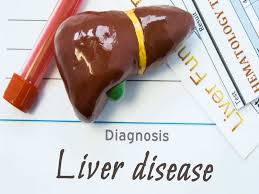 Shop amway us for a wide selection of high quality products today. These 8 Foods Can Help In Curing Fatty Liver Naturally Times Of India