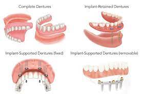 We did not find results for: What Do Dentures Cost And What Are My Options Dentist In Frederick Md