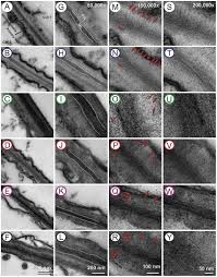 Check spelling or type a new query. Cell Wall Structure And Composition Is Affected By Light Quality In Tomato Seedlings Sciencedirect