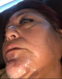 Firework blew in his face. Stay safe Y'all a firework just hit a boys  face... ••• Pls stay safe Plsstaysafe u . Y'all  Y'llfireworkjusthitaboys.fa... Y' all a firework just hit a boys