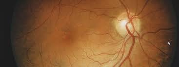 The washington eye institute is a full service ophthalmology practice that provides for the eye care needs for its patients in the dc metro area. Eye Care Services In Washington Eye Exams Washington