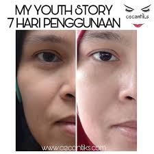 Kulit kusam memang bikin penampilan jadi kurang oke. Masalah Kulit Muka Kering Dan Mengelupas Youth Skincare Shaklee Umi Nazrah