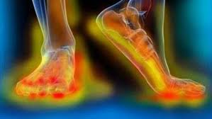 Din punctul de vedere al localiz ă. Neuropatia PerifericÄƒ Post Chimioterapie Terapia Scrambler