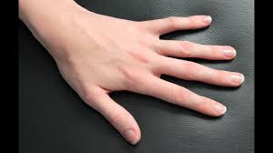 Un panaris est une infection localisée, le plus souvent autour d'un ongle du pied ou de la main. Tuto Soignez Un Debut De Panaris Remede De Grand Mere Youtube