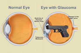 A police officer who seldom leaves the police. Synergy Firearms On Twitter Glockoma Makeitcount Synergyfirearms Eye Eyes Eyesight Glaucoma Damagetotheopticnerve