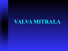 Insuficienta mitrala se imparte in acute si cronica. Ppt Eco 2008 Daniel Ghitau Academia Edu