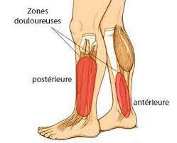 En finir avec le mal. La Periostite Tibiale Zoom Sur La Cheville Pied