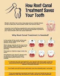 Sincere Tooth Extraction Quotes Toothcrown Wisdomteethyoutube Root Canal Treatment Root Canal Dental Posts