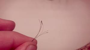 Image result for Hair Pull Test